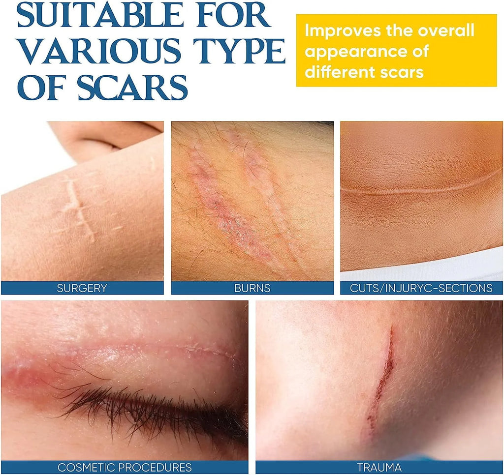 Scar Cream Gel with Allantoin and Retinol D184